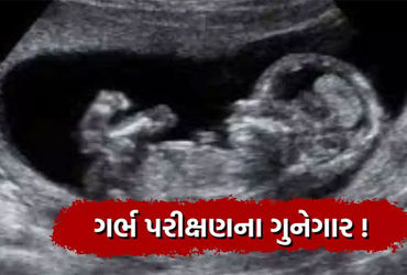 કેશોદમાં રહેણાંક મકાનમાંથી નોંધણી વગરનું સોનોગ્રાફી મશીન પકડાયું