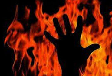 આગ બાદ પતિએ પત્નીને નવડાવ્યું, સાસુ પણ દાઝી