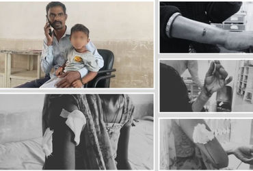 અમરેલીમાં હડકાયા શ્વાનનો આતંક: ખાંભાના ચકરાવા ગામે બાળકો અને મહિલાઓ સહિત 6 લોકોને બચકા ભર્યા