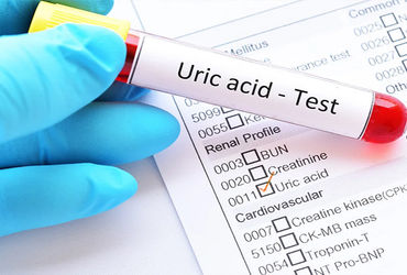 ભારતીય યુવાનોમાં Uric Acidનું વધતું પ્રમાણ ગંભીર બીમારીઓનું જોખમ વધારે છે.