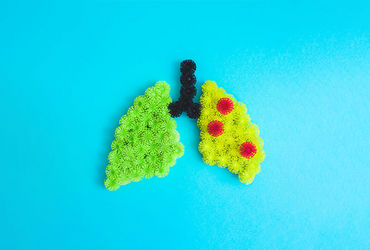 Urban areas may increase respiratory infection risk among young kids: Study - Vimarsana News