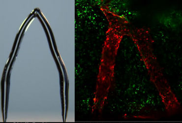 3D ice printing can create artificial blood vessels in engineered tissue - Vimarsana News