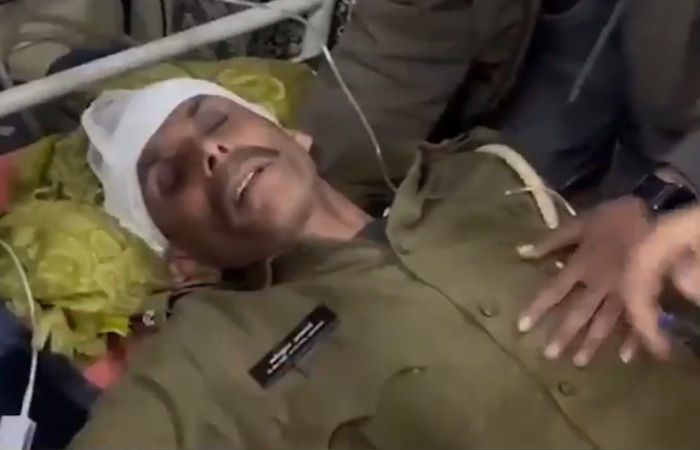 દાંતામાં પોલીસ-ફોરેસ્ટ અધિકારીની ટીમ પર પથ્થર અને તીર-કામઠાંથી હુમલો, 45થી વધુ જવાન ઘાયલ 3 - image