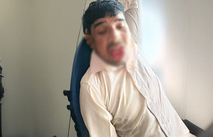 માથાફરેલા પ્રેમીને યુવતીએ ભણાવ્યો પાઠ! બળજબરીથી ચુંબન કરવા જતા જીભ કાપી નાખી 1 - image