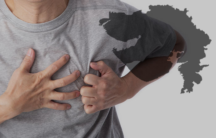 Heart related issues spikes in Gujarat 10 cases reported every hour