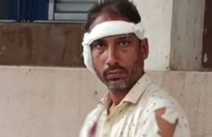 નવસારી: ભત્રીજાએ કાકાનો કાન બચકું ભરી છૂટો પાડ્યો, સર્જરી કરી જોડ્યો, આરોપીની ધરપકડ 1 - image