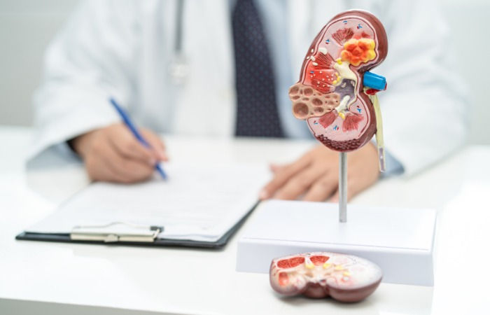 Scientists engineer gut bacteria with built-in safety switch to tackle kidney stones