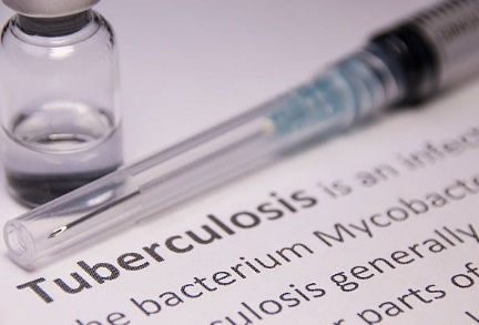 Screening for both active and dormant TB infection key to improve detection: Study