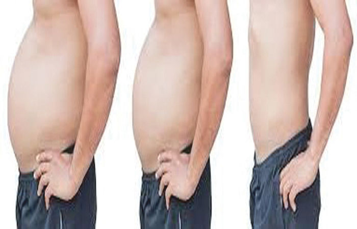 ઓબેસીટીઃ વજન ઉતારવાનો તગડો બિઝનેસ 2 - image