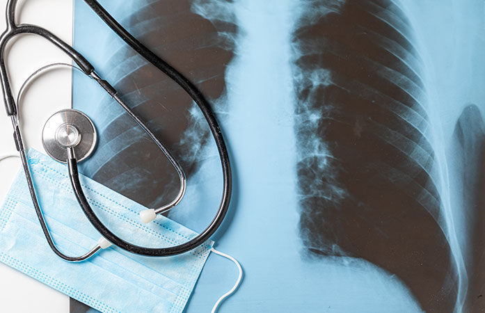 TB burden remains high in Gujarat despite elimination claims