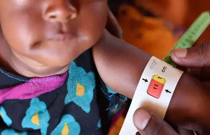 Tribal Child Malnutrition in Gujarat