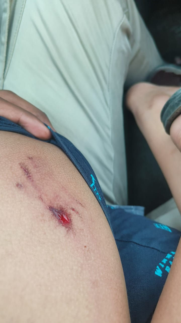 અમદાવાદમાં પાલતુ શ્વાને બાળક પર હુમલો કરતાં ઇજાગ્રસ્ત, માલિક સામે ગુનો નોંધાયો 3 - image