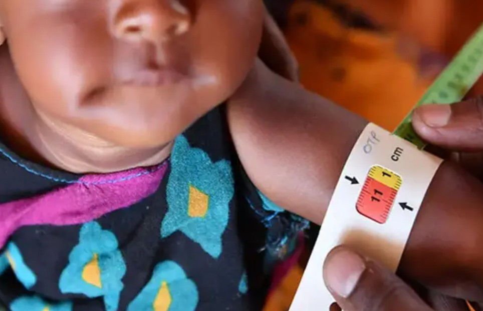 ₹509 cr spent on ‘Malnutrition Free Gujarat’, yet 5.40 lakh children malnourished