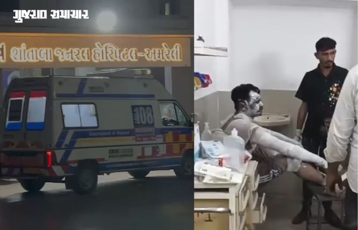 અમરેલીના જેસીંગપરામાં ઘર પાસે પાર્ક કરેલી કારમાં અચાનક આગ લાગી, 4 લોકો દાઝી ગયા 2 - તસવીર