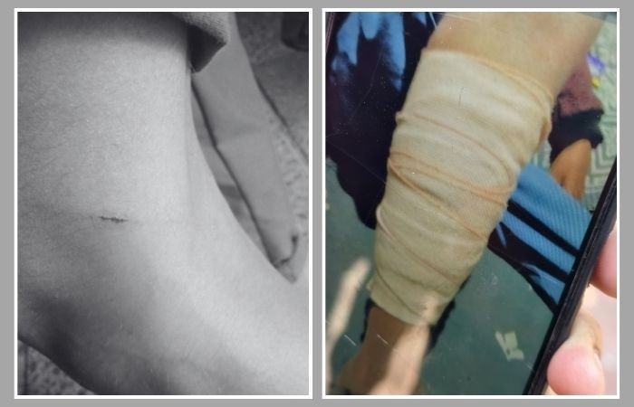 ગાંધીનગર: વાવોલની શાળામાં કારનો કાચ તૂટતા પ્રિન્સિપાલે વિદ્યાર્થીઓને માર્યો ઢોર માર, વાલીઓમાં રોષ 2 - image