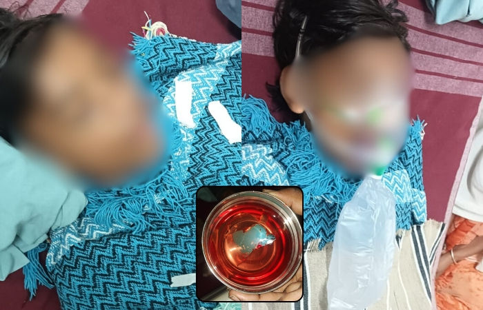 ગોધરા: સ્ટીલના ગ્લાસમાં ફટાકડો ફોડનારો કિશોર ગંભીર રીતે ઈજાગ્રસ્ત, સ્ટીલનો ટુકડો નાકમાં ઘૂસી ગયો 2 - image