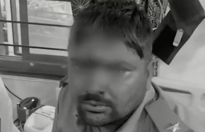 દાંતામાં પોલીસ-ફોરેસ્ટ અધિકારીની ટીમ પર પથ્થર અને તીર-કામઠાંથી હુમલો, 45થી વધુ જવાન ઘાયલ 8 - image