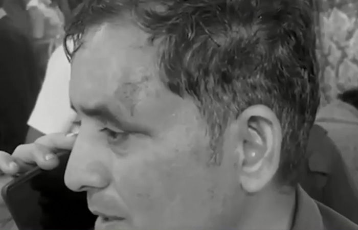 દાંતામાં પોલીસ-ફોરેસ્ટ અધિકારીની ટીમ પર પથ્થર અને તીર-કામઠાંથી હુમલો, 45થી વધુ જવાન ઘાયલ 5 - image