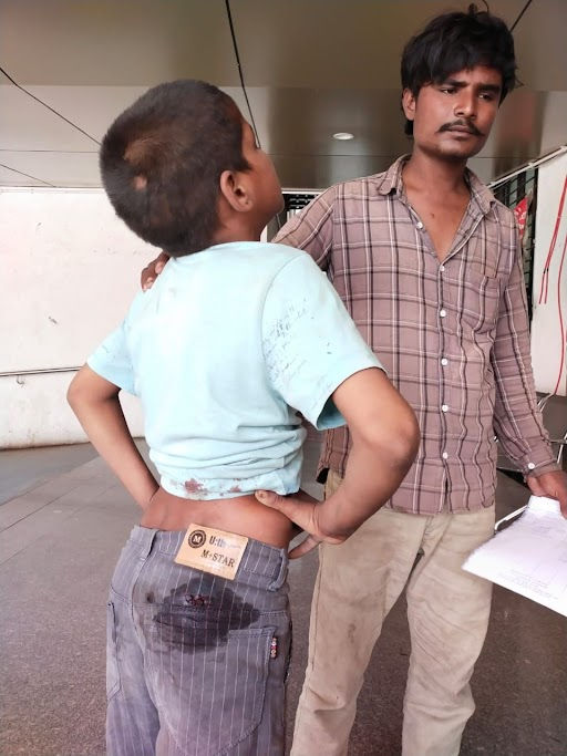 સુરતમાં રખડતા કુતરા નો આતંક યથાવત 4 - image