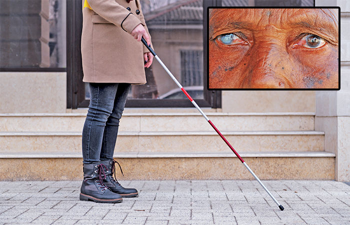 તો ભારતમાં 80% લોકોને અંધત્વ આવતા પહેલા રોકી શકાય ! 1 - image