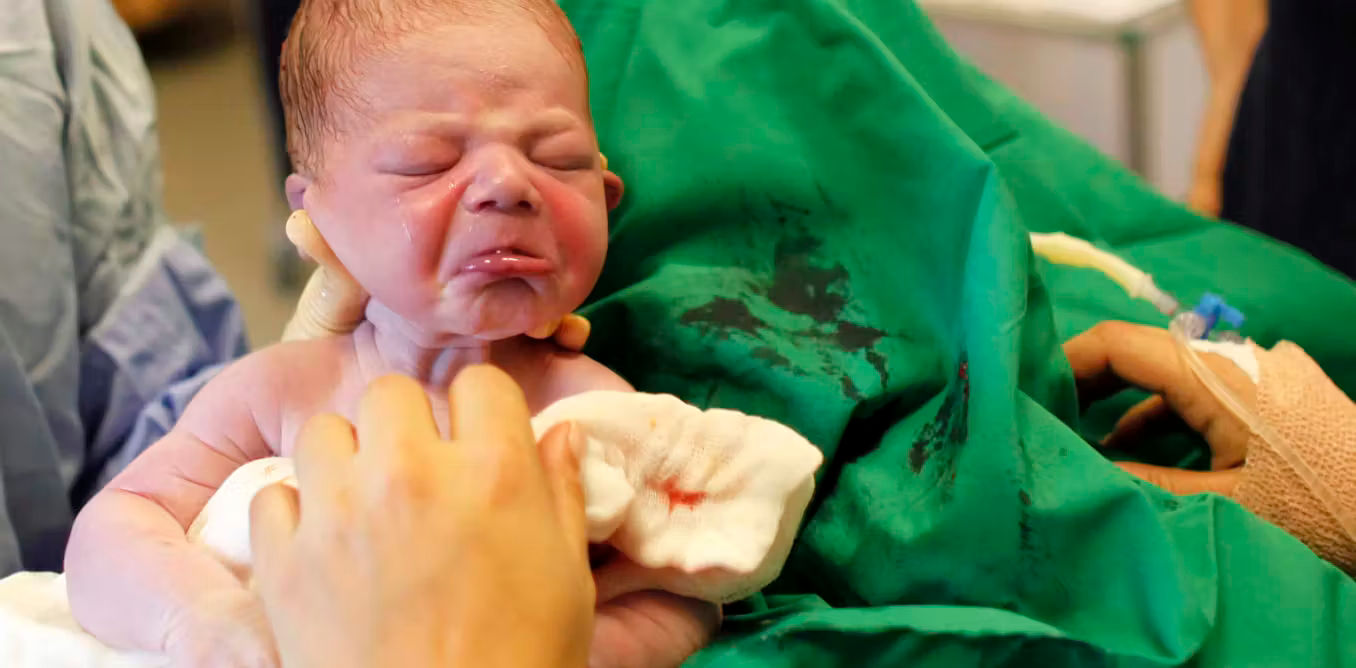 તુર્કીમાં સિઝેરિયન પર કેમ પ્રતિબંધ મુકાયો ? મેડિકલ કારણ વિના પરવાનગી મળશે નહી 1 - image