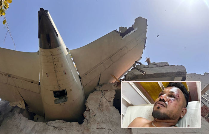 'હું જીવતો છું, પણ રોજ મરું છું', એર ઇન્ડિયા ક્રેશના એકમાત્ર બચી ગયેલા વિશ્વાસ કુમારની હૃદયદ્રાવક આપવીતી 1 - image