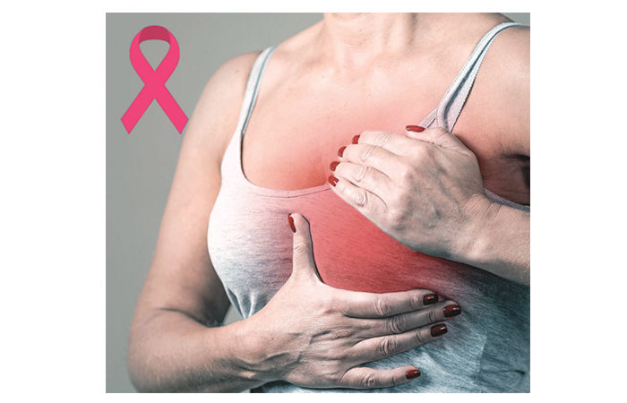 સ્તન કેન્સર . 1 - image