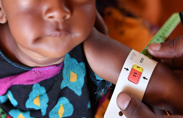 ગુજરાતના 10 જિલ્લામાં 1.73 લાખથી વધુ બાળકો કુપોષિત, બનાસકાંઠા-પંચમહાલમાં સૌથી વધુ બાળકો કુપોષણનો શિકાર 1 - image